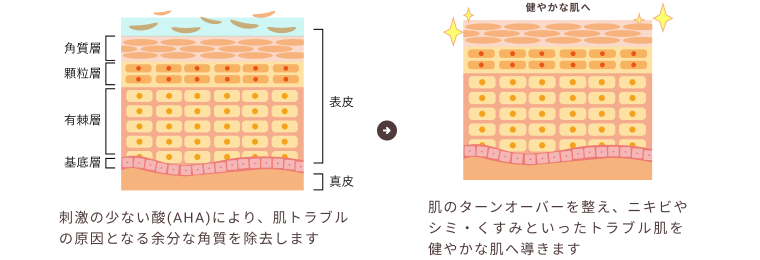 ケミカルピーリングの仕組み